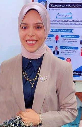 Esraa Yasser Fouad Ebrahim Medina 